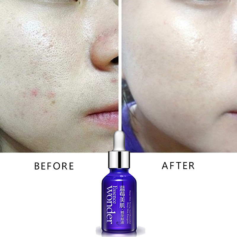 BIOAQUA عنبية الوجه رفع المصل  - مراجعة Skincare Garnier وسعره