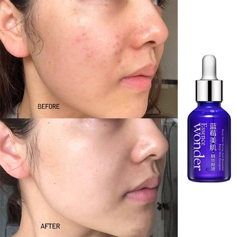 BIOAQUA عنبية الوجه رفع المصل  - مراجعة Skincare Garnier وسعره